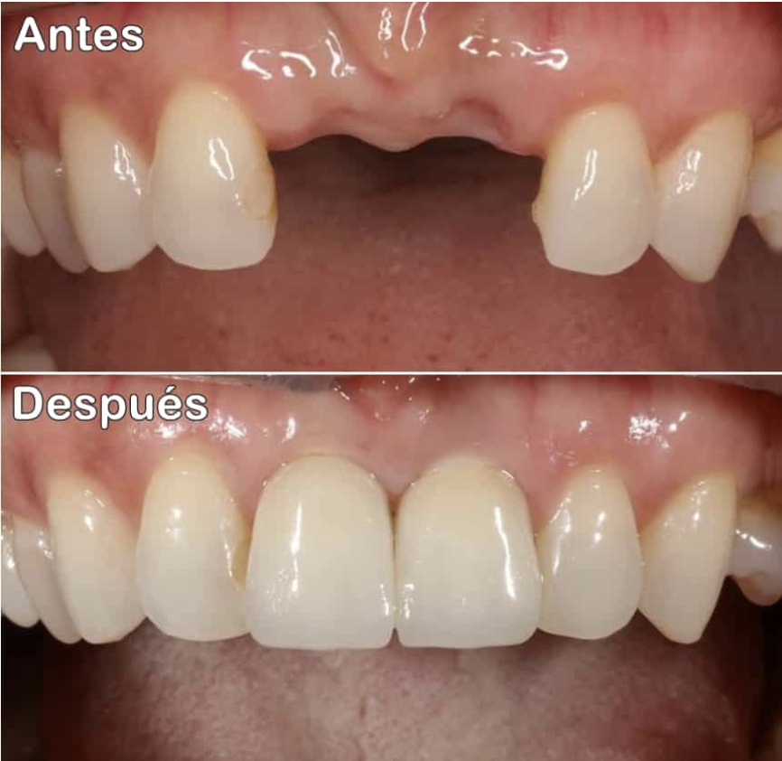 Captura de pantalla 2026-02-17 a las 14.50.18